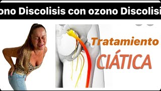 Ciatica y ozonoterapia [upl. by Cari]