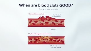 Anticoagulants [upl. by Neelav]