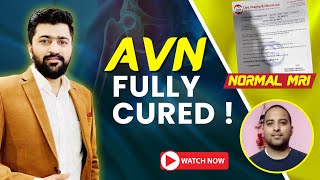 AVN Reversal Story  Normal MRI without Surgery  Ayurveda Treatment  9424842988  Dr Avinash Singh [upl. by Oneil]