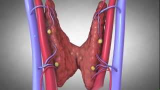 Parathyroides et Lhyperparathyroïdisme [upl. by Ailadi]