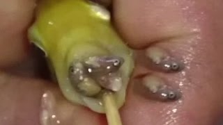 Mother Yellow fish giving birth to 33 baby fish [upl. by Asselim]