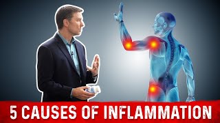 Stop the 5 Causes of Inflammation FAST – Dr Berg [upl. by Barnaba959]