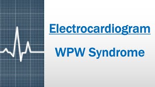 WPW syndrome Electrocardiogram [upl. by Laved859]