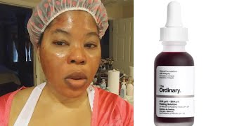 The Ordinary AHA 30  BHA 2 Exfoliating Peeling Solution Good Or Bad My Review [upl. by Fredrick873]