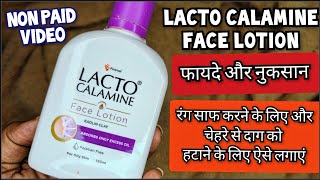 Lacto Calamine Face Lotion लैक्टो कैलामाइन लोशन  How to use lacto calamine lotion Review In Hindi [upl. by Aleahcim]