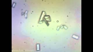 Feline Urine Sample with Struvite Crystals 4 Microscope Camera [upl. by Klinges]