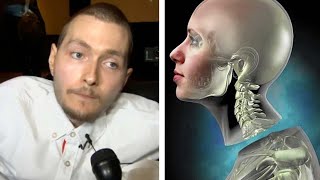 What Happened To The First Human Head Transplant Feat Medlife Crisis [upl. by Prudy736]