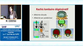 IRM du rachis lombaire pour le rhumatologue Pr M EDDERAI [upl. by Artenra]