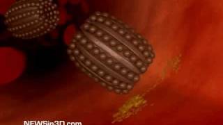 Nanobots Flowing Through a Blood Vessel [upl. by Nelli827]