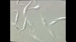 Trypanosoma [upl. by Akeimahs]