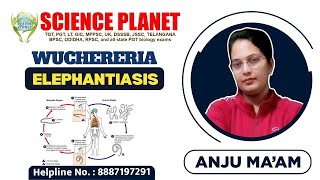 WUCHERERIA ELEPHANTIASIS II BY ANJU MAM II SCIENCE PLANET II [upl. by Gerson]