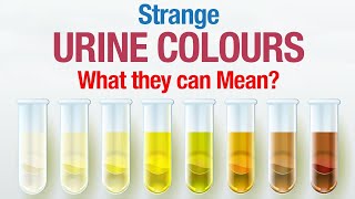 Urine Colour and its Effect on your Health [upl. by Klump]