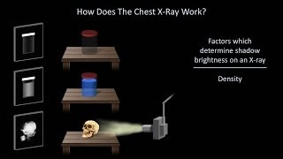 How to Interpret a Chest XRay Lesson 1  An Introduction [upl. by Epilef]