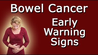 Early Warning Signs Of Bowel Cancer [upl. by Alia148]