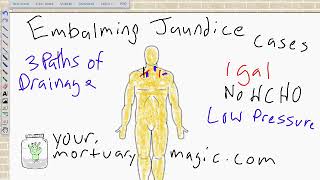 Embalming the Jaundice Case [upl. by Middendorf]