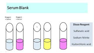 Serum bilirubin Estimation  english [upl. by Esertal]