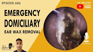 686  Emergency Domiciliary Ear Wax Removal [upl. by Shirleen]