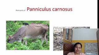 Panniculus Carnosus Remnants [upl. by Ardnua]