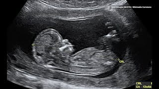 This is What Babies Kicking in the Womb are Really Doing [upl. by O'Driscoll]