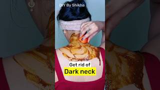 How to get rid of dark neck  black neck home remedies treatment shorts [upl. by Arnuad]