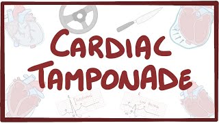 Cardiac tamponade  causes symptoms diagnosis treatment pathology [upl. by Aili300]