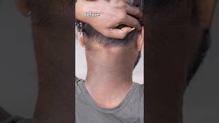 Remove Neck Darkness At Home In 5min  Neck Cleaning Tips  Dark Neck Remove Home Remedies shorts [upl. by Liborio]