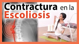 🛑 Dónde está la CONTRACTURA en la ESCOLIOSIS ▶ EJERCICIO para MEJORAR Yoga Terapéutico 😲 WOOOW [upl. by Arimlede]