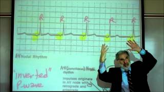 CARDIAC PHYSIOLOGY PART 3 by Professor Finkwmv [upl. by Iain]