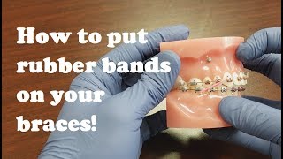 Tutorial How to put rubber bands on your braces [upl. by Vetter]