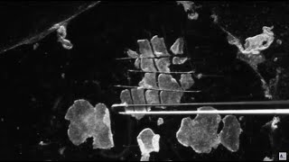 3 Methods for Passaging of Pluripotent Stem Cells [upl. by Ellehs961]