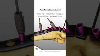 Depuy Elbow Plating System biology science muscletype [upl. by Liggitt623]