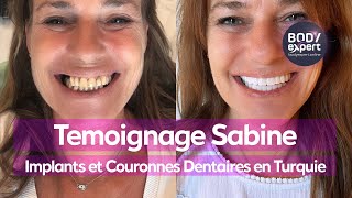 SOINS DENTAIRES  🦷 Témoignage Sabine  8 implants  22 couronnes dentaires Emax  BODYEXPERT [upl. by Iris428]