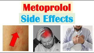 Metoprolol amp Beta Blockers Side Effects amp Why They Occur [upl. by Dedrick]