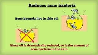 How Accutane Works for You [upl. by Naujuj993]