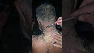 Husband Haircut Dandruff old flake very bad condition😱😳 dandruff removal satisfying part12 [upl. by Dlonyar2]