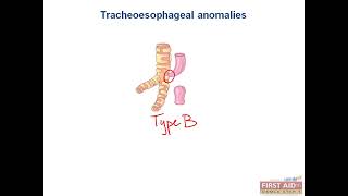 Gastroenterology GIT embryology video from USMLE First Aid Step One 1 [upl. by Ajan]