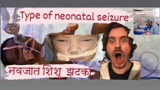 सावधान  अपने बच्चो में ऐसी हरकत देखें तो डाक्टर की सलाह ले  babydocter neonatecare nicu [upl. by Poland]