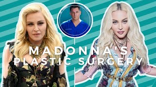 Madonnas Recent Plastic Surgery  Why Cher Looks Good [upl. by Niamreg]