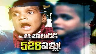 526 teeth removed from a 7yearold boy’s jaw in Chennai [upl. by Xaviera416]