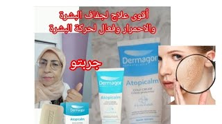 Dermagor Atopicalm كريم فعال👌يخلي وجهكبلارة مجربلعلاج التهيج والتشققاتواقي شمسي الحساسية [upl. by Ewald]