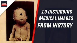 10 Disturbing Medical Images from History [upl. by Ummersen]