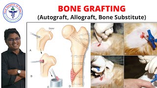 BONE GRAFTING  Lecture 05  Orthopedics [upl. by Limak]