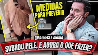 MEDIDAS PARA PREVENIR SOBRA DE PELE QUANDO EMAGRECER [upl. by Sabine654]