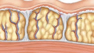 How Cellulite Reduction Creams Work [upl. by Spenser]