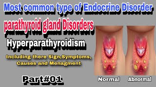 Hyperparathyroidism  Parathyroid gland Disorder By AbuBakar Med Plus [upl. by Nnaed411]