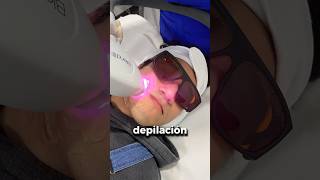 DEPILACIÓN LÁSER PARA HOMBRES cuidadodelapiel depilacion depilacionlaser [upl. by Heyra]