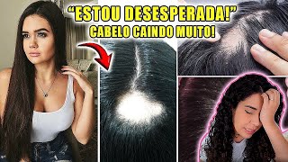 FRANCINY EHLKE PERDENDO TODO CABELO BURACO NA CABEÇA [upl. by Tikna113]