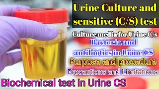 Urine Culture and Sensitivity CS test full explained [upl. by Deena]