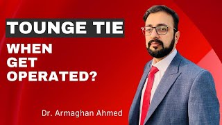 Tounge Tie  Tandwa  تندوا  When get Operated  Dr Armaghan Ahmed [upl. by Ladnik925]