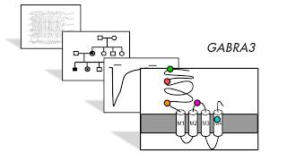 Rare GABRA3 variants are associated with epileptic seizures encephalopathy and dysmorphic features [upl. by Adnarem]